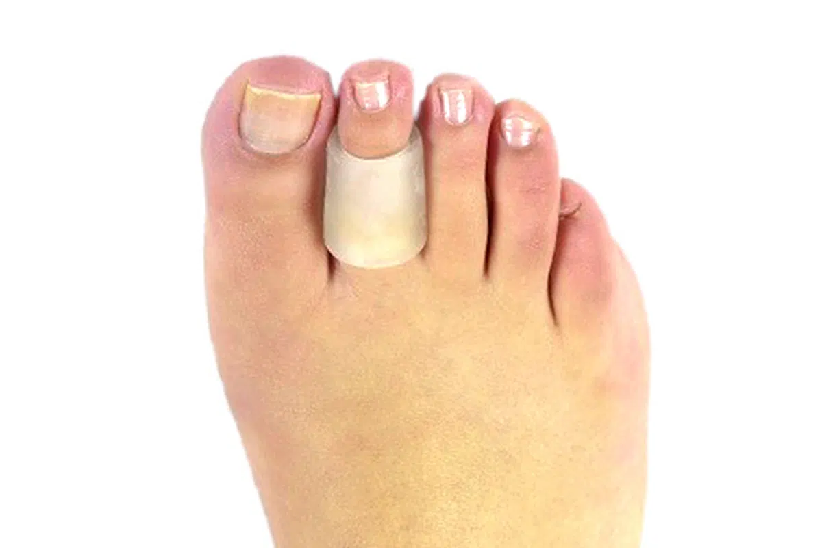 Anillo de gel polímero