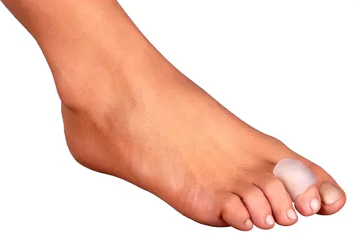 Anillo rector para dedos en garra